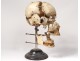 Skull burst with Beauchêne anatomy House Tramond Paris medicine nineteenth