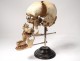 Skull burst with Beauchêne anatomy House Tramond Paris medicine nineteenth