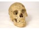 Human skull old medicine flayed anatomy Vanity articulated jaw 19th