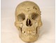 Human skull old medicine flayed anatomy Vanity articulated jaw 19th