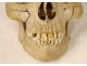 Human skull old medicine flayed anatomy Vanity articulated jaw 19th