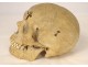 Human skull old medicine flayed anatomy Vanity articulated jaw 19th