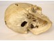 Human skull old medicine flayed anatomy Vanity articulated jaw 19th