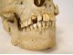 Human skull old medicine flayed anatomy Vanity articulated jaw 19th