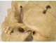 Human skull old medicine flayed anatomy Vanity articulated jaw 19th