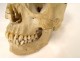 Human skull old medicine flayed anatomy Vanity articulated jaw 19th